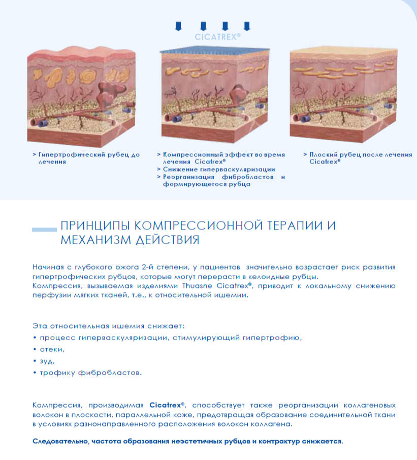 CICATREX® Пояс-трусы — изображение 2